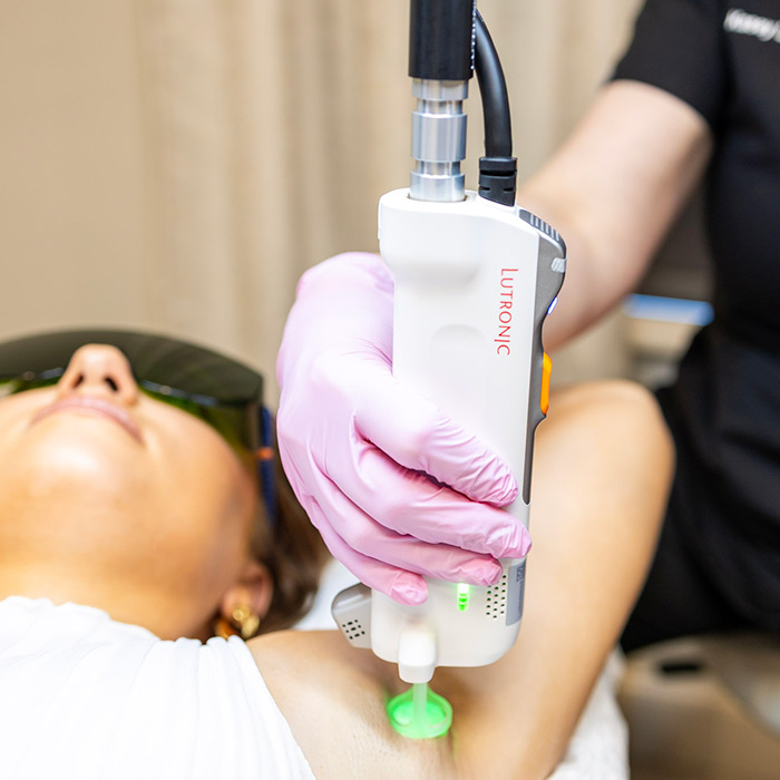 a person getting laser hair removal treatment