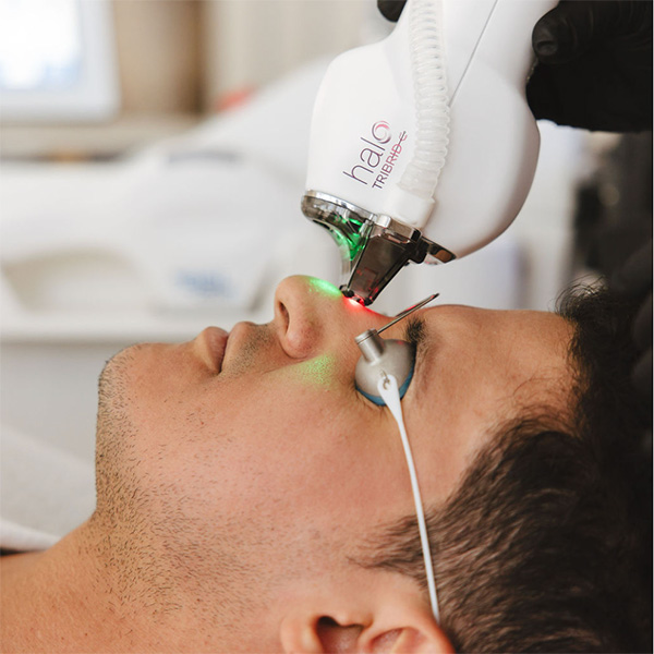 TRIBRID HALO Laser Treatment