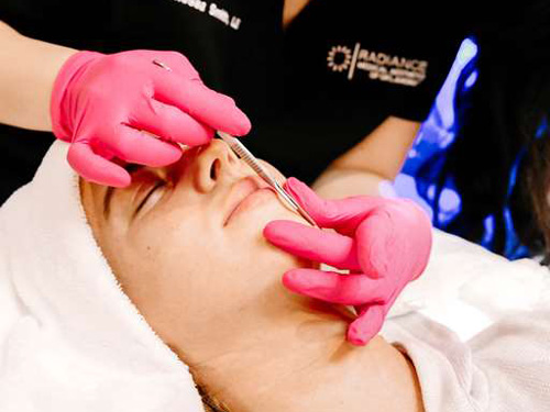 Young lady getting Dermaplaning for skin exfoliation in Oklahoma City